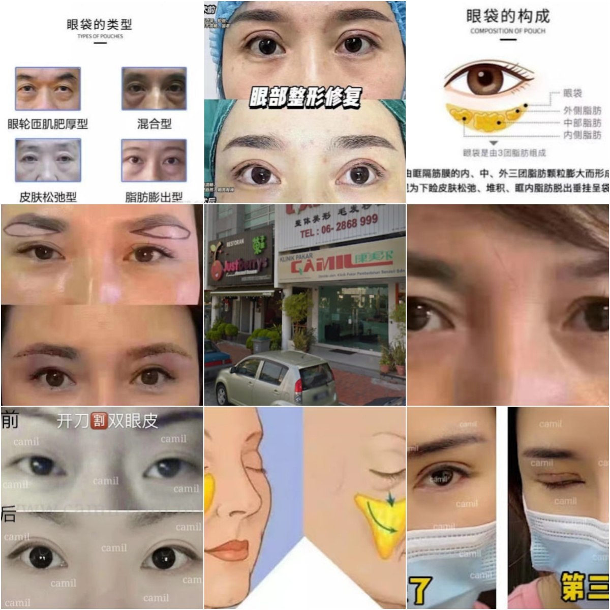 👩‍⚕马六甲Camil Melaka Centre👩‍⚕